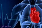 ارتباط سروصدا با زیاد کردن ریسک حمله قلبی